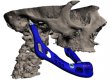 Медики виготовили людську щелепу за допомогою 3D-принтера