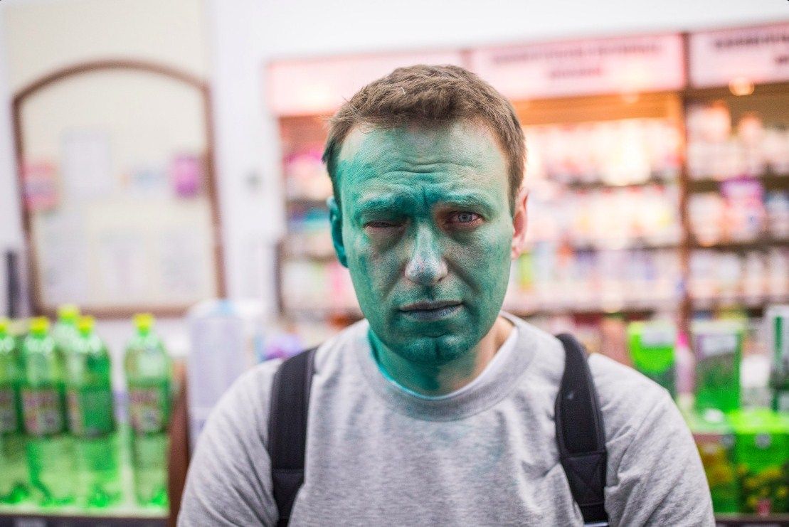 Зеленка попала в глаз Навальному. Фото: navalny.com