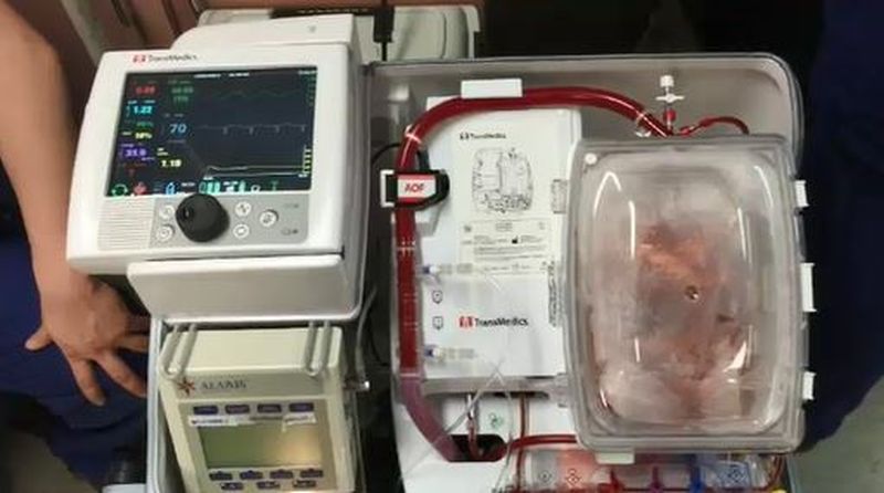 Больница купила машину для ухода за органами. Фото: 9News.