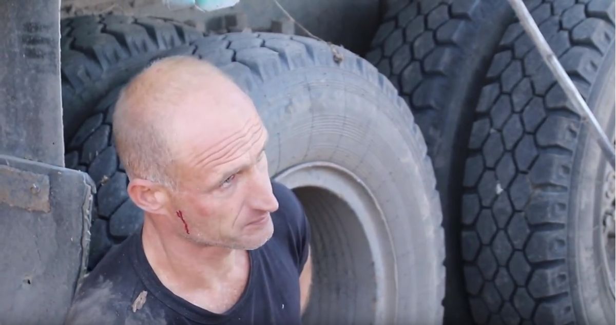 Пострадавший житель с. Веприк