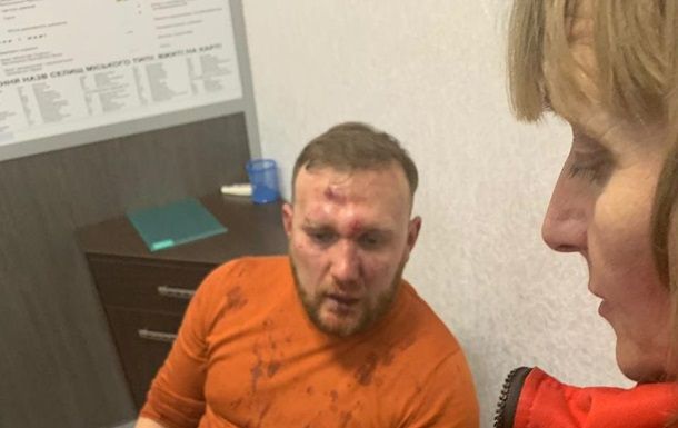 Пострадавшего от нападения неонацистов политконсультанта Андрея Бодрова обследуют медики 12 декабря 2018 г.