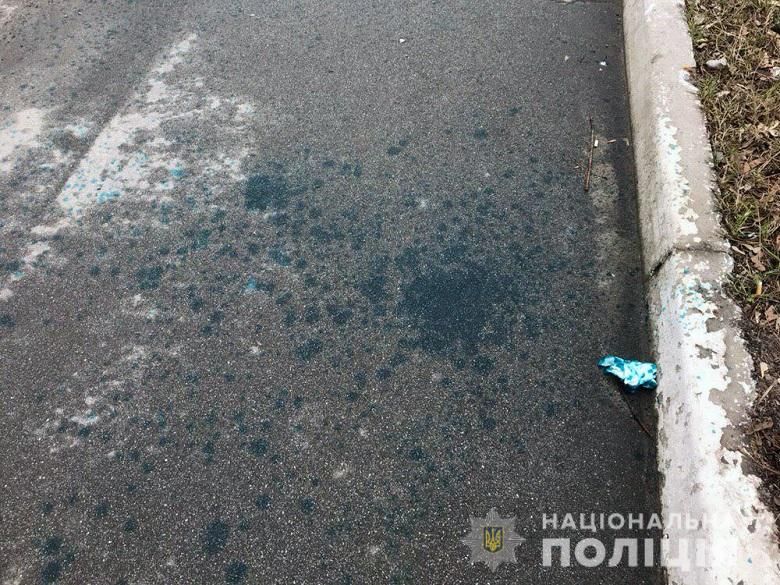 напали На суддю у столиці і облили зеленкою