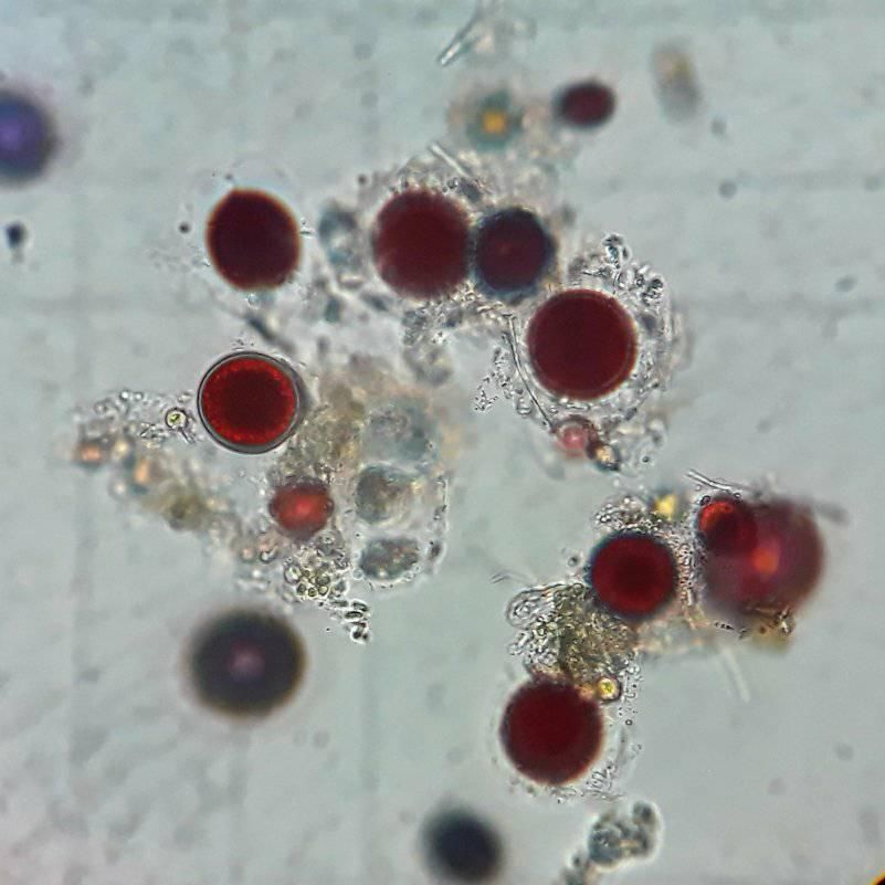 Водоросли под микроскопом. Фото: