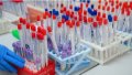 World Bank Ready To Allocate USD 230 Million To Ukraine In December To Ensure Vaccination And Fight Covid-19