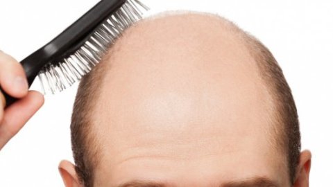 ​Ученые нашли новый способ борьбы с облысением