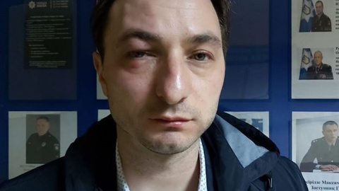 Главврач Национального института рака Андрей Безносенко. Фото: facebook.com/beznosenko.andriy
