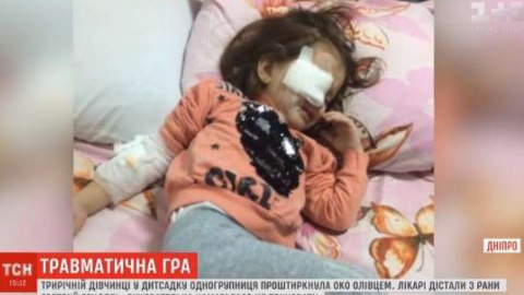 Трирічній дівчинці проткнули око олівцем в дитячому садку в Дніпрі