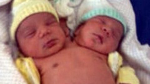 Еманоель і Жезус добре почуваються в одному тілі.