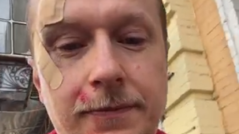 Майкла Щура побили. Скріншот відео Facebook Майкл Щур