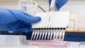 Сoronavirus SARS-CoV-2/ Photo by Xinhua.