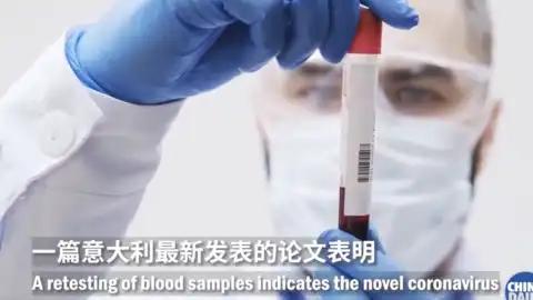 Blood samples point to early COVID-19 infections in Italy, – China Daily
