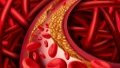 Chinese researchers find new way to lower lipid levels. Picture by Xinhua.