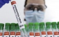 China-based researchers develop rapid testing methods for monkeypox virus. Photo by Xinhua.