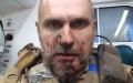 Sentsov was wounded during landing at front