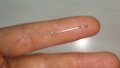 Chinese researchers invent new nerve electrode for stroke treatment. Photo by Xinhua.