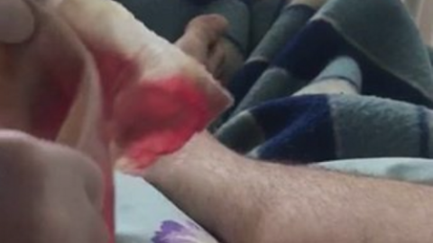 Дейдей опублікував відео перев'язки і попросив дати йому спокій