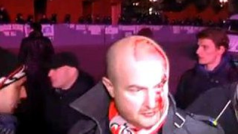 Очевидцы сообщили, что молодых людей, в том числе женщин, били дубинками, тащили по земле, били ногами. Скриншот с видеоролика
