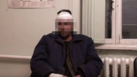 СБУ виявила жорстоко побитого бойовиками і пораненого жителя Горлівки