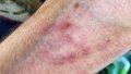 In Kherson, woman bites policeman to prevent him and territorial recruitment center