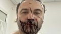 Shahed hits russian oppositionist Ilya Ponomarev’s house in Kyiv Region