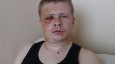 Шапошникова сильно избили.