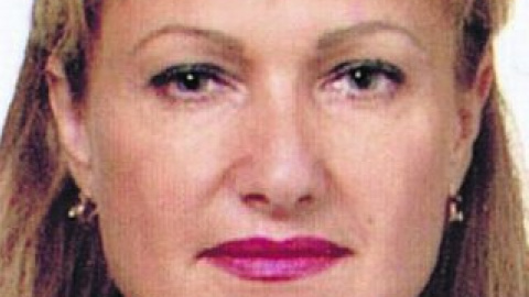 50-летняя киевлянка хотела убрать мешки под глазами и носогубные складки.