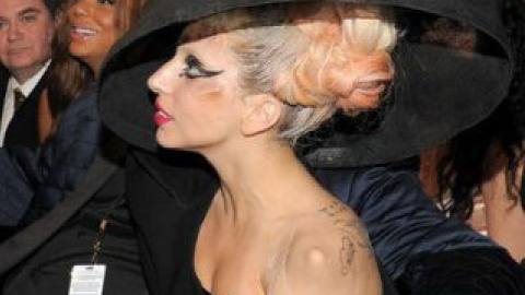 Lady Gaga.