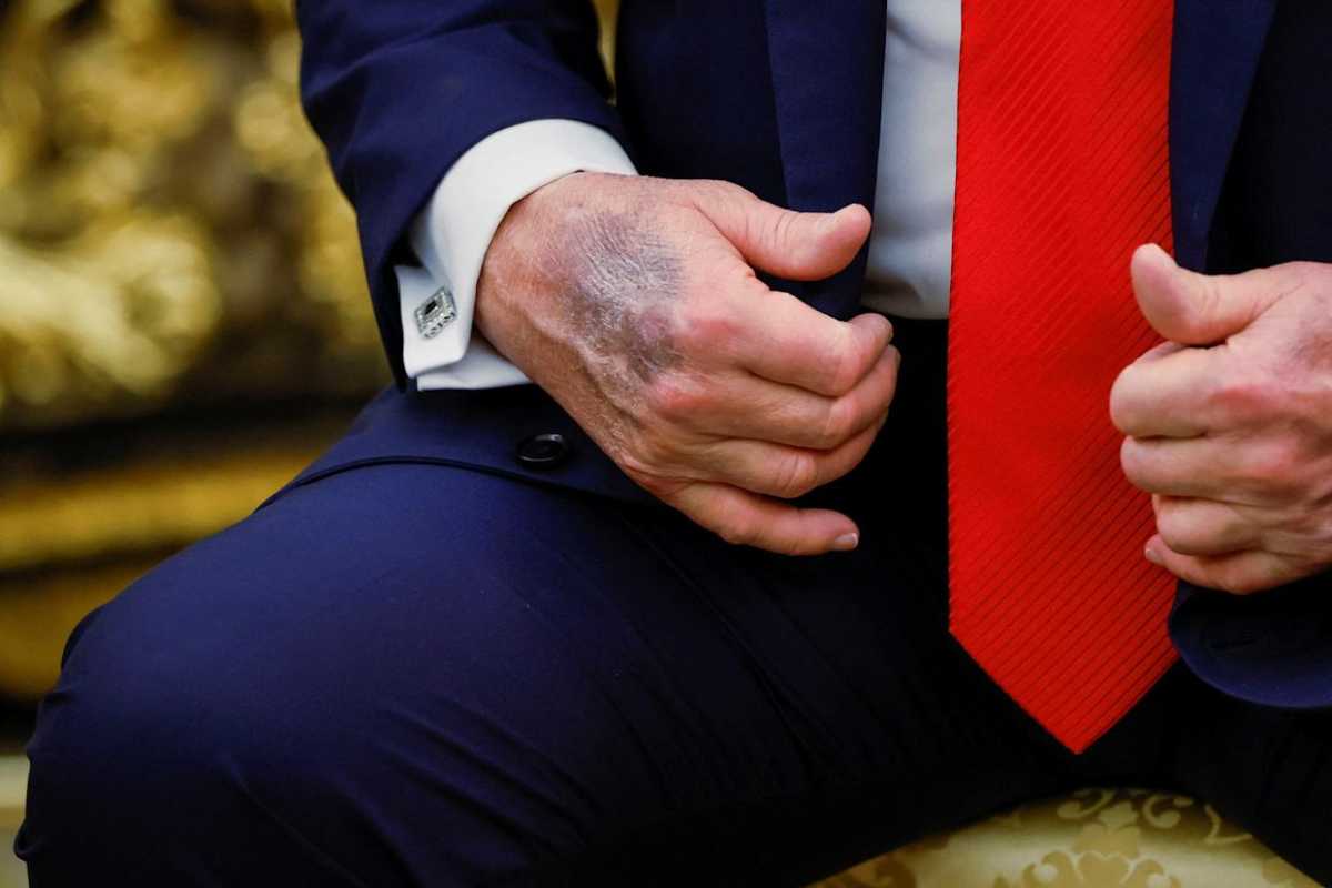 Рука Дональда Трампа. Фото: aol