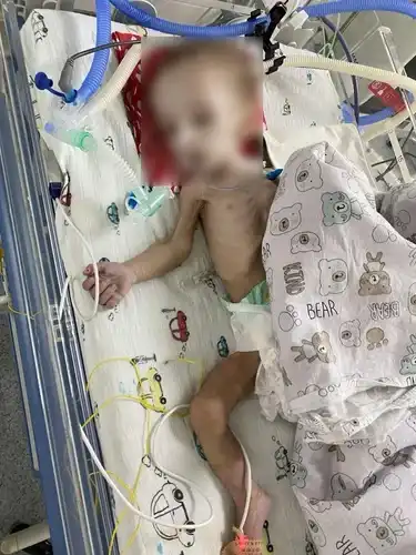 Семимісячного хлопчика шпиталізували в тяжкому стані. Фото, надане hromadske