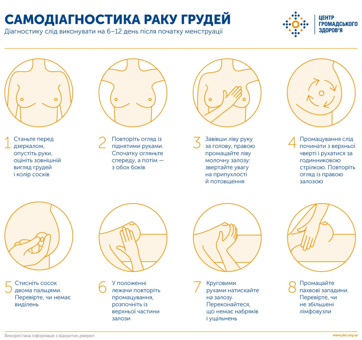 Самодіагностика раку грудей. Інфографіка: ЦГЗ