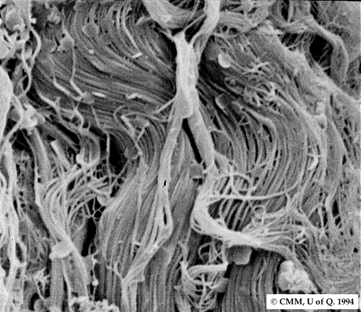 Волокна колагена під мікроскопом. Фото: cmm.centre.uq.edu.au