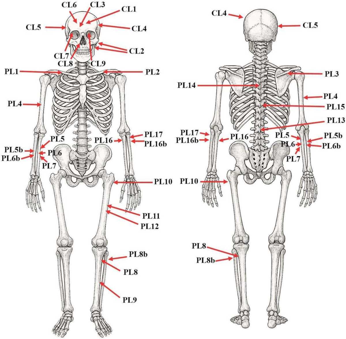 Схема пошкоджень на кістках Бели Ростиславовича. Hajdu et al. / Forensic Science International: Genetics, 2025