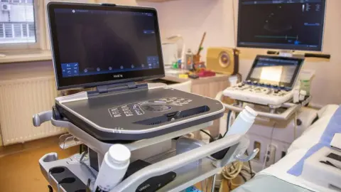 Новий апарат-УЗД в Інституті серця