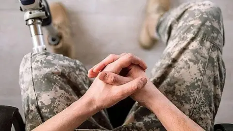 Протезування військових. Ілюстративне фото: armyinform